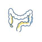 Home 782 rectal polyps condition 01 removebg preview.png